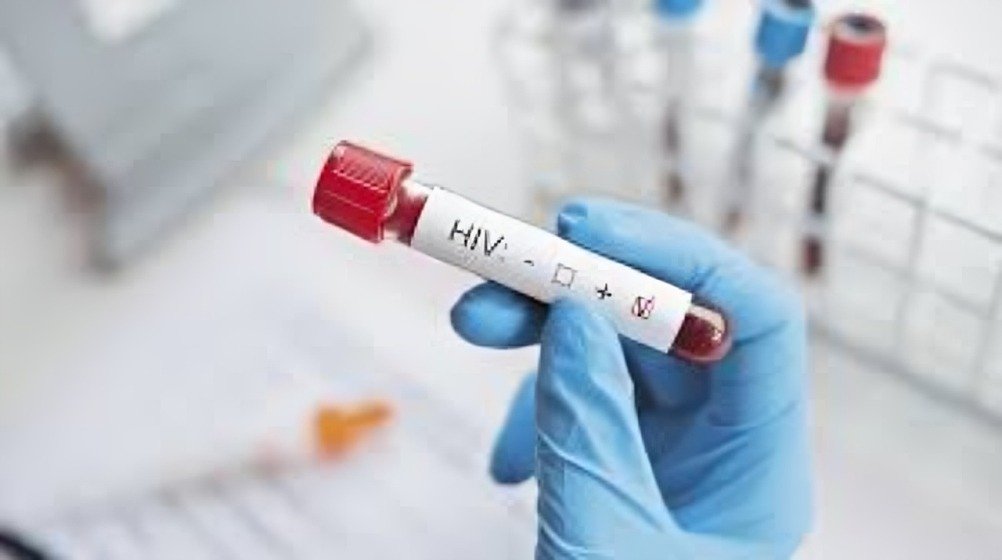 La terapia antirretroviral transforma el VIH en una enfermedad crónica, pero plantea nuevos desafíos