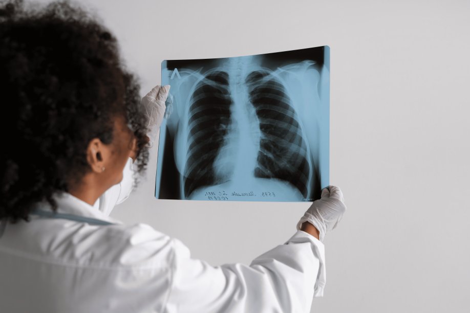 Médico revisando pulmones de paciente con hipertensión arterial pulmonar en Ecuador