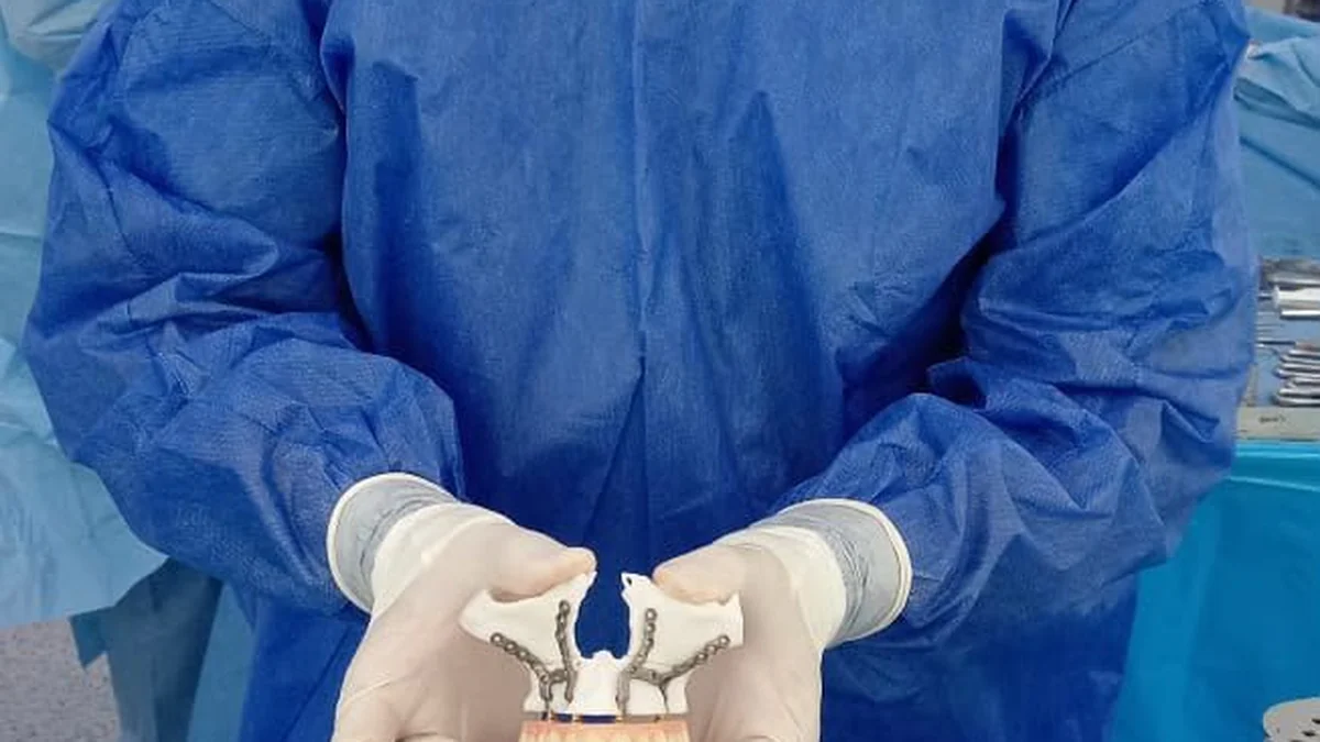 Modelo tridimensional de anatomía usado para planificar una cirugía en Ecuador