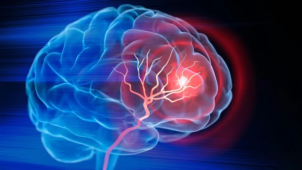 Estudio de neuroimagen y tomografía computarizada del cerebro humano