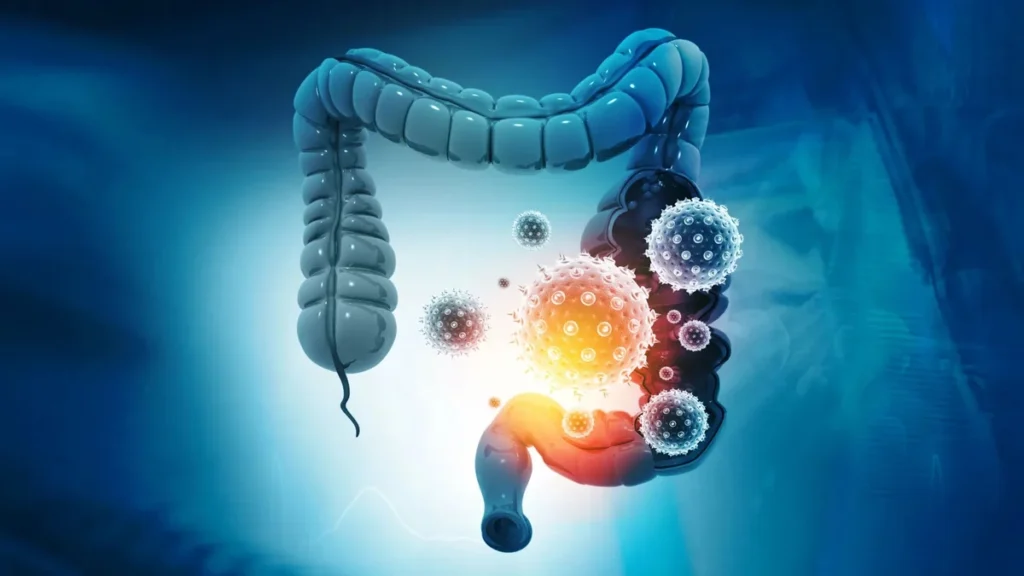 Descubren cómo una bacteria común causa cáncer digestivo