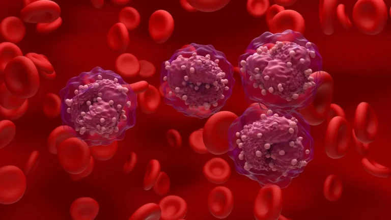 Células de leucemia en sangre analizadas bajo microscopio en laboratorio de oncología.