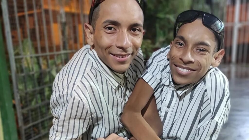Familia de siameses en Ecuador solicita privacidad para el último adiós