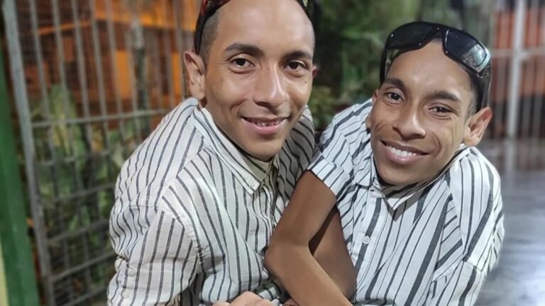 Familia de siameses en Ecuador solicita privacidad para el último adiós
