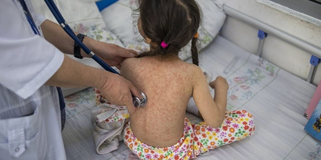 Nueva York declara emergencia sanitaria ante un repunte de casos de sarampión